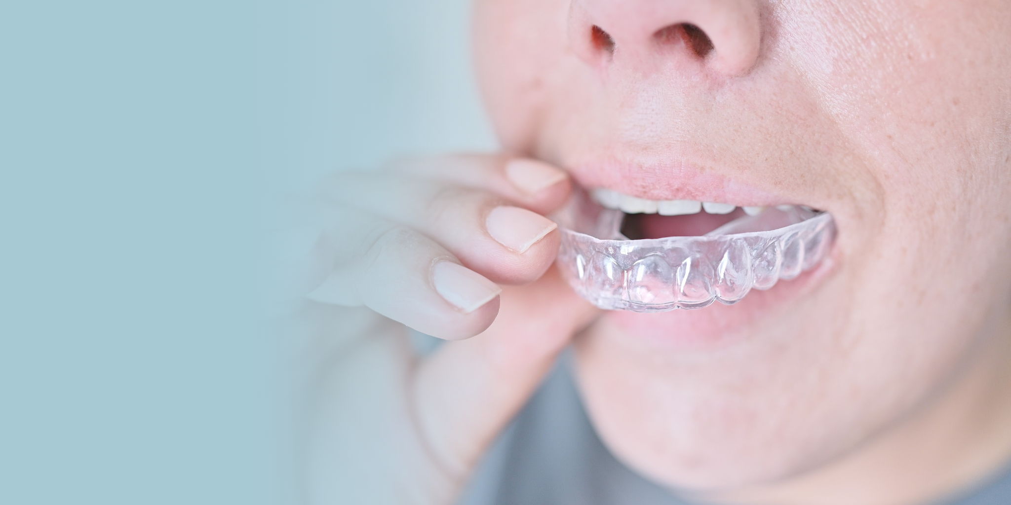 クリアコレクト イメージ